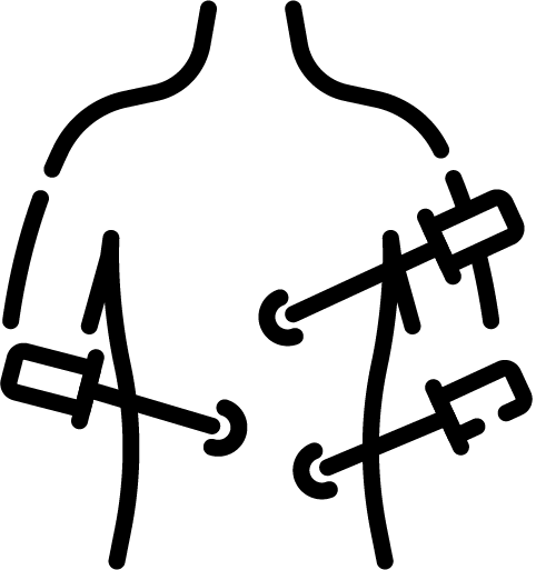 Laparoscopia flavicon - B. Medical